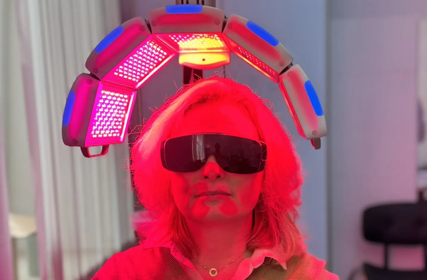 Фотодинамическая терапия волос