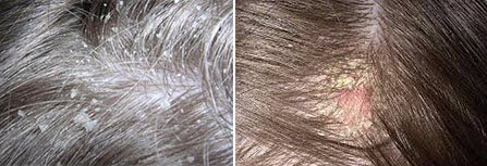 Клиника восстановление волос у мужчин
