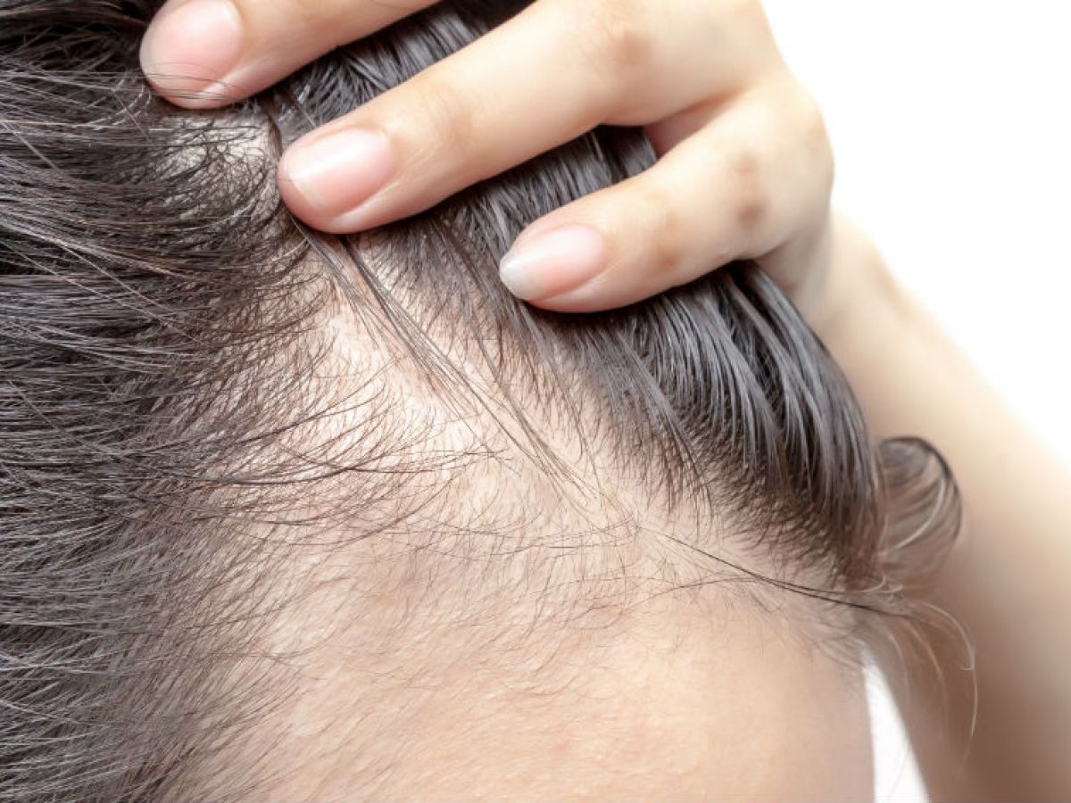 Почему волосы медленно растут на голове: основные причины